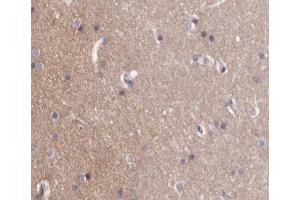 ABIN6267257 at 1/200 staining human brain tissue sections by IHC-P. (ABL1 抗体  (pTyr412))