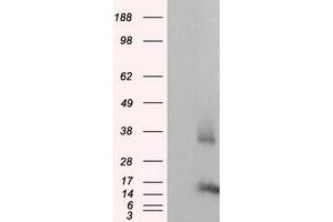 Western Blotting (WB) image for anti-CDGSH Iron Sulfur Domain 1 (CISD1) antibody (ABIN1497521) (CISD1 抗体)