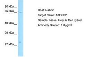 Image no. 1 for anti-Activating Transcription Factor 7 Interacting Protein 2 (ATF7IP2) (AA 100-149) antibody (ABIN6750085)