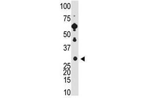 Image no. 1 for anti-Recoverin (RCVRN) (C-Term) antibody (ABIN357114) (Recoverin 抗体  (C-Term))