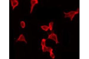ABIN6267645 staining HeLa by IF/ICC. (Cortactin 抗体  (pTyr421))