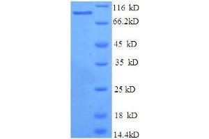 Bone Morphogenetic Protein 1 (BMP1) (AA 121-986) protein (His tag)