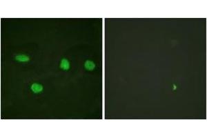 Immunofluorescence analysis of HeLa cells, using 53BP1 (Ab-6) Antibody. (TP53BP1 抗体  (AA 1-50))