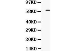 Western Blotting (WB) image for anti-Transcription Factor 7-Like 1 (T-Cell Specific, HMG-Box) (TCF7L1) (AA 561-588), (C-Term) antibody (ABIN3044552)