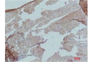 Immunohistochemistry (IHC) analysis of paraffin-embedded Mouse Skeletal Muslce Tissue using AMPKalpha1 Polyclonal Antibody.