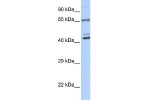 WB Suggested Anti-ZNF324 Antibody Titration:  0. (ZNF324 抗体  (Middle Region))
