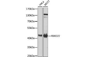 Western blot analysis of extracts of various cell lines, using FBXO22 antibody (ABIN6131311, ABIN6140516, ABIN6140517 and ABIN6224399) at 1:1000 dilution. (FBXO22 抗体  (AA 104-403))
