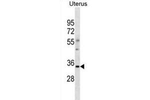 OR6S1 Antibody (C-term) (ABIN1881609 and ABIN2838743) western blot analysis in human Uterus tissue lysates (35 μg/lane). (OR6S1 抗体  (C-Term))