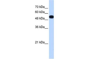 UGP2 antibody used at 0. (UGP2 抗体  (N-Term))