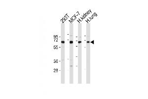 All lanes : Anti-TIEG Antibody (N-term) at 1:2000 dilution Lane 1: 293T whole cell lysates Lane 2: MCF-7 whole cell lysates Lane 3: human kidney lysates Lane 4: human lung lysates Lysates/proteins at 20 μg per lane. (KLF10/TIEG1 抗体  (N-Term))