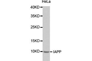 Western blot analysis of extracts of HeLa cells, using IAPP antibody (ABIN2974276). (Amylin/DAP 抗体)