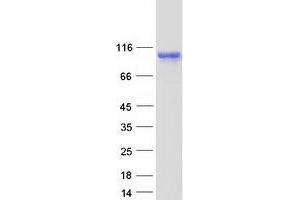 Western Blotting (WB) image for SRY (Sex Determining Region Y)-Box 6 (SOX6) (Transcript Variant 1) protein (Myc-DYKDDDDK Tag) (ABIN2732468)