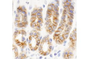 Immunohistochemistry (IHC) image for anti-C2 Calcium Dependent Domain Containing 5 (C2CD5) (AA 375-425) antibody (ABIN7454753) (C2CD5/KIAA0528 抗体  (AA 375-425))