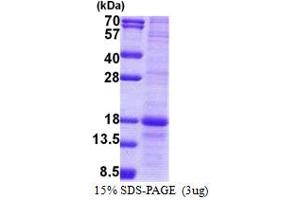 SDS-PAGE (SDS) image for Lymphocyte Antigen 86 (LY86) (AA 21-162) protein (His tag) (ABIN5853100) (LY86 Protein (AA 21-162) (His tag))