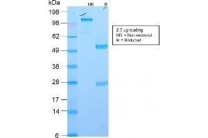 SDS-PAGE Analysis Purified EpCAM Rabbit Recombinant Monoclonal Antibody (EGP40/2571R). (Recombinant EpCAM 抗体  (Extracellular Domain))