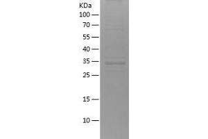 Western Blotting (WB) image for BCL2-Associated X Protein (BAX) (AA 1-110) protein (His-IF2DI Tag) (ABIN7282110) (BAX Protein (AA 1-110) (His-IF2DI Tag))
