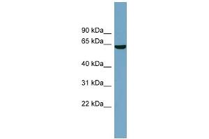 WB Suggested Anti-SLC5A8 Antibody Titration:  0. (SLC5A8 抗体  (Middle Region))