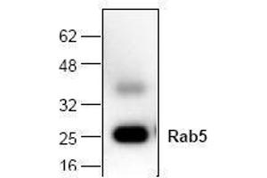 Image no. 1 for anti-RAB5A, Member RAS Oncogene Family (RAB5A) antibody (ABIN127153) (RAB5 抗体)