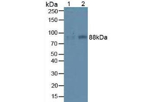 Western blot analysis of (1) Mouse Liver Tissue and (2) Mouse Lung Tissue. (ITGB1 抗体  (AA 454-714))