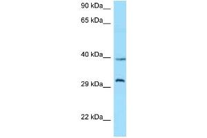 WB Suggested Anti-GHSR Antibody Titration: 1. (GHSR 抗体  (C-Term))