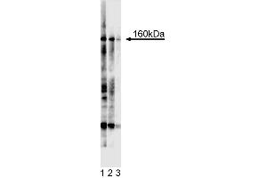 Western blot analysis for Tie2. (TEK 抗体  (Extracellular Domain))