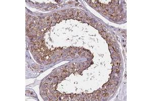 Immunohistochemical staining of human testis with FAM70B polyclonal antibody  shows moderate cytoplasmic and membranous positivity in cells of seminiferus ducts. (TMEM255B 抗体)
