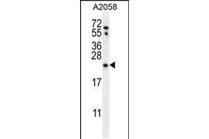 Western blot analysis in A2058 cell line lysates (35ug/lane). (RAB10 抗体  (AA 89-117))