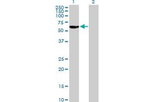 Western Blot analysis of RARG expression in transfected 293T cell line by RARG MaxPab polyclonal antibody. (Retinoic Acid Receptor gamma 抗体  (AA 1-454))
