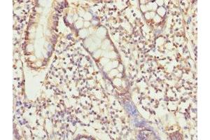 Immunohistochemistry of paraffin-embedded human small intestine tissue using ABIN7174300 at dilution of 1:100 (USP26 抗体  (AA 664-913))