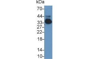 Detection of APOE in Rat Serum using Monoclonal Antibody to Apolipoprotein E (APOE) (APOE 抗体  (AA 19-168))