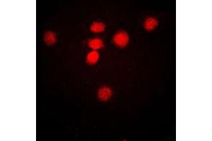 Immunofluorescent analysis of MRE11 staining in HeLa cells. (Mre11 抗体  (Center))