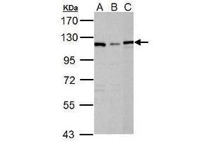 WB Image Sample (30 ug of whole cell lysate) A: Raji B: K562 C: NCI-H929 7. (DPYD 抗体)