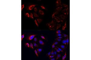 Immunofluorescence analysis of U2OS cells using SAA3 antibody. (Serum Amyloid A3 Pseudogene (SAA3P) 抗体)
