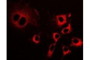 Immunofluorescent analysis of LIM staining in HepG2 cells. (PDLIM5 抗体)
