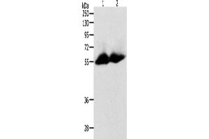 Western Blotting (WB) image for anti-Matrix Metallopeptidase 11 (Stromelysin 3) (MMP11) antibody (ABIN2431667) (MMP11 抗体)