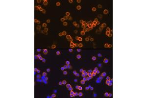 Immunofluorescence analysis of Raw264 7 cells using EMR1 Rabbit pAb (ABIN3021857, ABIN3021858, ABIN3021859 and ABIN6216234) at dilution of 1:100 (40x lens). (F4/80 抗体  (AA 21-290))