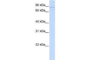 WB Suggested Anti-SLITRK6 Antibody Titration:  0. (SLITRK6 抗体  (N-Term))