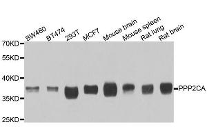 Western blot analysis of extracts of various cell lines, using PPP2CA antibody. (PPP2CA 抗体  (AA 1-309))