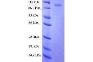 SDS-PAGE (SDS) image for Keratin 6A (KRT6A) (AA 2-564) protein (GST tag) (ABIN5709833)