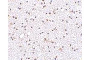 Immunohistochemistry of TOCA-1 in human brain tissue with this product at 2. (FNBP1L 抗体  (C-Term))
