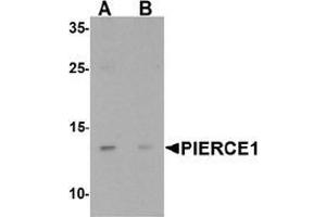 Western blot analysis of PIERCE1 in A20 cell lysate with PIERCE1 Antibody  at 1 µg/mL in (A) the absence and (B) the presence of blocking peptide. (C9ORF116 抗体  (N-Term))