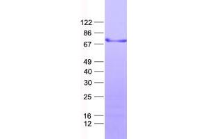 Western Blotting (WB) image for Zinc Finger and BTB Domain Containing 44 (ZBTB44) protein (His tag) (ABIN2715345)