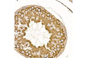Immunohistochemistry (IHC) image for anti-TNF Receptor-Associated Factor 2 (TRAF2) (AA 1-300) antibody (ABIN3021165)