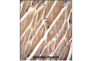PIP5KL1 Antibody (N-term) (ABIN655244 and ABIN2844847) immunohistochemistry analysis in formalin fixed and paraffin embedded human skeletal muscle followed by peroxidase conjugation of the secondary antibody and DAB staining. (PIP5KL1 抗体  (N-Term))