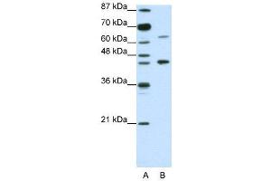 WB Suggested Anti-RARA  Antibody Titration: 1. (Retinoic Acid Receptor alpha 抗体  (N-Term))