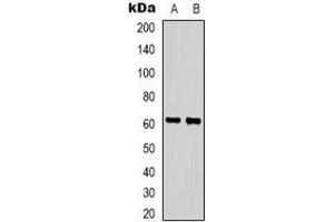 Western blot analysis of ZNF397 expression in HepG2 (A), Hela (B) whole cell lysates. (ZNF397 抗体  (N-Term))