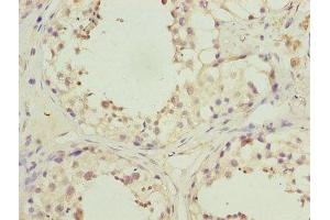 Immunohistochemistry of paraffin-embedded human testis tissue using ABIN7163973 at dilution of 1:100 (KCND1 抗体  (AA 410-647))
