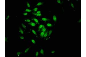 Immunofluorescence staining of Hela cells with ABIN7162487 at 1:133, counter-stained with DAPI.