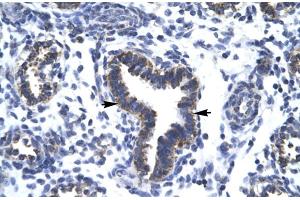 Immunohistochemistry (IHC) image for anti-RNA Binding Motif Protein 10 (RBM10) (N-Term) antibody (ABIN2779276)