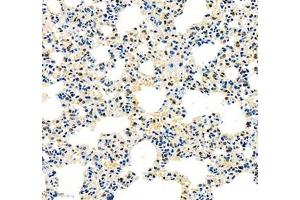 Immunohistochemistry (Paraffin-embedded Sections) (IHC (p)) image for anti-High Mobility Group Nucleosome Binding Domain 1 (HMGN1) antibody (ABIN7074222)